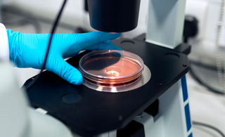 Disrupted Oral Cell Renewal: The Key to Dental Health and Bad Breath